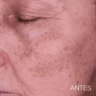 Jabón de Cúrcuma Natural - ¡LIBERATE DE LAS MANCHAS Y EL ACNE! 🧼🍂 Paga 1 y Lleva 2😱