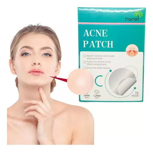 Parche para Acné (72pz) | hanel
