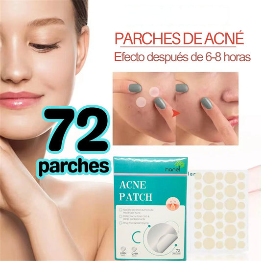 Parche para Acné (72pz) | hanel